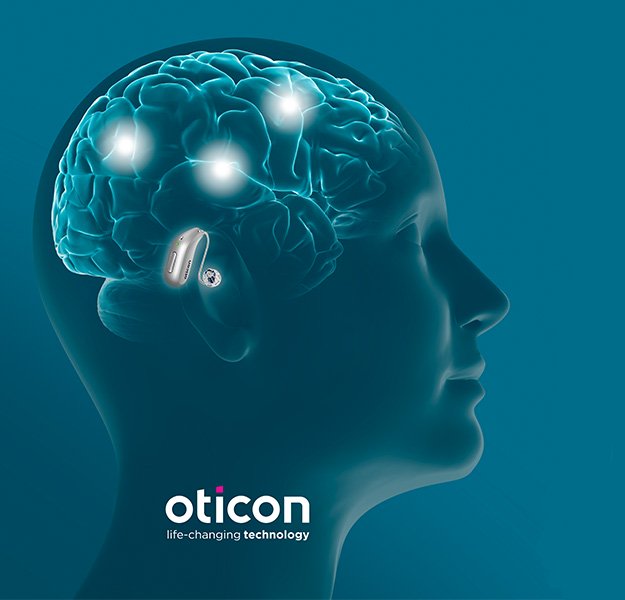 oticon-brain-hearing-technology-hearing-aid